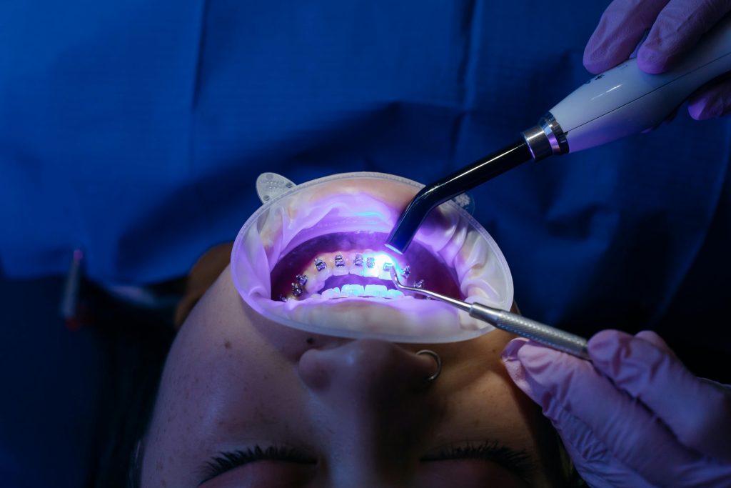 Braces cost Myrtle Beach
